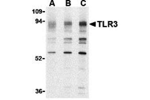 Western Blotting (WB) image for anti-Toll-Like Receptor 3 (TLR3) (N-Term) antibody (ABIN1031621) (TLR3 antibody  (N-Term))