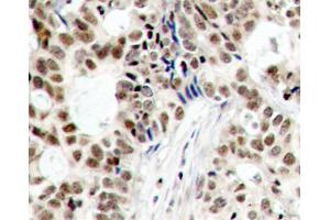 Immunohistochemistry (IHC) image for anti-Breast Cancer 1 (BRCA1) (pSer1423) antibody (ABIN6225497)