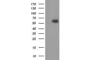 HEK293T cells were transfected with the pCMV6-ENTRY control (Left lane) or pCMV6-ENTRY EXD1 (Right lane) cDNA for 48 hrs and lysed. (EXD1 antibody)