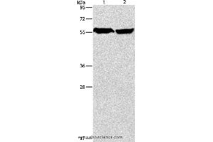 Western blot analysis of Mouse heart and human fetal brain tissue, using ARHGEF9 Polyclonal Antibody at dilution of 1:950