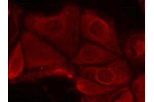 Immunofluorescence staining of methanol-fixed MCF7 cells using p70 S6 Kinase(Phospho-Ser411) Antibody. (RPS6KB1 antibody  (pSer411))