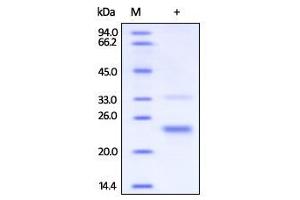 Human CD160, His Tag on SDS-PAGE under reducing (R) condition. (CD160 Protein (CD160) (AA 27-159) (His tag))