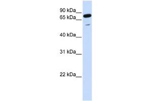 WB Suggested Anti-PPP1R13L Antibody Titration:  0.