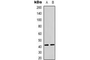 Western blot analysis of PEX10 expression in MCF7 (A), Jurkat (B) whole cell lysates. (PEX10 antibody)