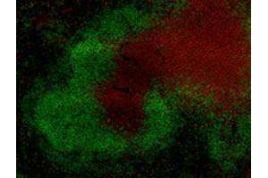 Immunofluorescence (IF) image for anti-T Cell Receptor (TCR) beta (TCR beta) antibody (Alexa Fluor 594) (ABIN2656861) (TCR beta antibody  (Alexa Fluor 594))