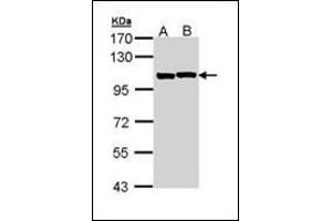 Sample (30 ug of whole cell lysate). (ACTN2 antibody)