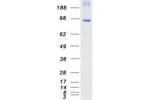 Validation with Western Blot (TAO Kinase 3 Protein (TAOK3) (Myc-DYKDDDDK Tag))