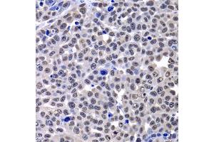 Immunohistochemistry of paraffin-embedded mouse cancer using H2AFY antibody (ABIN2562982) at dilution of 1:100 (40x lens). (H2AFY antibody)
