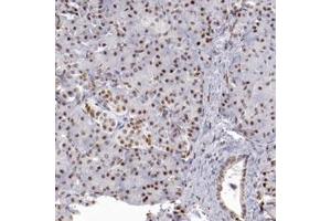Immunohistochemical staining of human pancreas with TFAP4 polyclonal antibody  shows moderate nuclear positivity in exocrine glandular cells and islet cells.