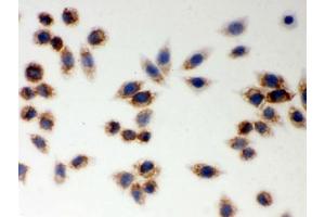 ICC testing of FFPE human SMMC-7721 cells with LYRIC antibody. (MTDH antibody  (AA 101-270))