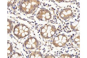 Immunohistochemistry analysis of paraffin-embedded human colon using IL22RA1 Polyclonal Antibody at dilution of 1:200. (IL22 Receptor alpha 1 antibody)