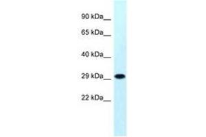 Image no. 1 for anti-Mitochondrial Ribosomal Protein S18B (MRPS18B) (AA 45-94) antibody (ABIN6747860) (MRPS18B antibody  (AA 45-94))