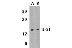 Western Blotting (WB) image for anti-Interleukin 21 (IL21) (Middle Region) antibody (ABIN1030955) (IL-21 antibody  (Middle Region))