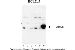 Sample Type: 1. (BCL2L1 antibody  (N-Term))
