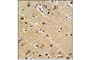 Immunohitochemistry: ZWINT Antibody staining of Formalin-Fixed, Paraffin-Embedded Human Brain Tissue. (ZWINT antibody  (Middle Region))