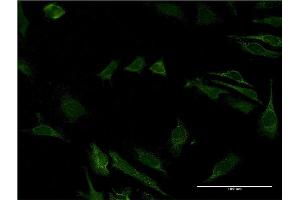 Immunofluorescence of monoclonal antibody to CD40 on HeLa cell. (CD40 antibody  (AA 21-193))
