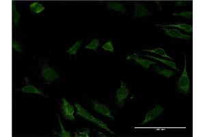 Immunofluorescence of monoclonal antibody to CD40 on HeLa cell. (CD40 antibody  (AA 21-193))