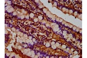 IHC image of ABIN7173930 diluted at 1:300 and staining in paraffin-embedded human small intestine tissue performed on a Leica BondTM system. (TUSC3 antibody  (AA 42-196))