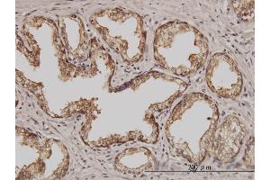 Immunoperoxidase of monoclonal antibody to PSMD5 on formalin-fixed paraffin-embedded human prostate. (PSMD5 antibody  (AA 405-504))
