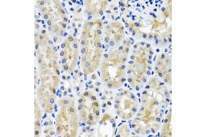 Immunohistochemistry of paraffin-embedded mouse kidney using SNAP29 antibody. (SNAP29 antibody)