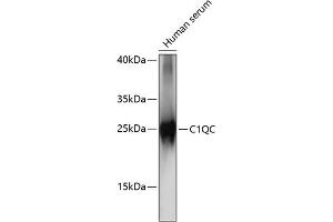 Western blot analysis of extracts of human serum, using C1QC antibody (ABIN7266475) at 1:1000 dilution.