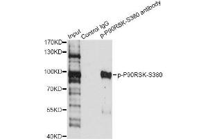 Immunoprecipitation analysis of 200 μg extracts of HeLa cells treated by EGF using 2. (RPS6KA3 antibody  (pSer380))