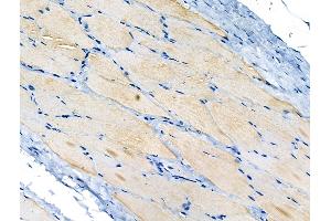 ABIN6264983 and ABIN6266656 at 1/100 staining Rat skin tissue by IHC-P.
