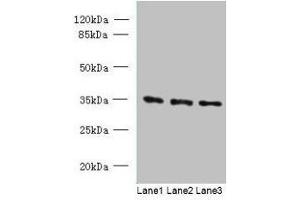 Western blot All lanes: C15orf41 antibody at 1. (BC052040 antibody  (AA 1-183))