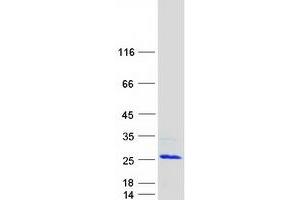Western Blotting (WB) image for High Mobility Group Nucleosomal Binding Domain 3 (HMGN3) (Transcript Variant 1) protein (Myc-DYKDDDDK Tag) (ABIN2722879)