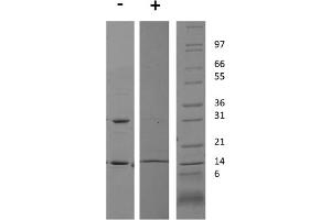 SDS-PAGE of Rat Interferon gamma Recombinant Protein SDS-PAGE Rat Interferon gamma Recombinant Protein. (IFNG1-2 Protein)