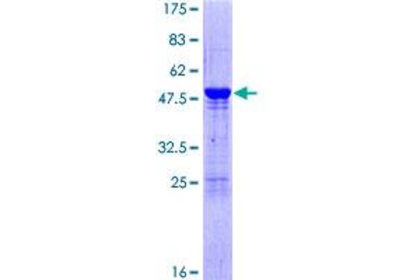 UBE2K Protein (AA 1-200) (GST tag)