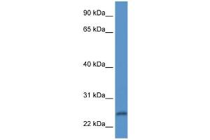 WB Suggested Anti-PI15 Antibody Titration: 1. (PI15 antibody  (N-Term))