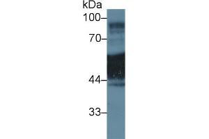 Western blot analysis of Human A431 cell lysate, using Rat KRT1 Antibody (1 µg/ml) and HRP-conjugated Goat Anti-Rabbit antibody ( (Cytokeratin 1 antibody  (AA 350-488))