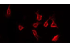 ABIN6266449 staining Hela by IF/ICC. (CCR5 antibody  (pSer349))