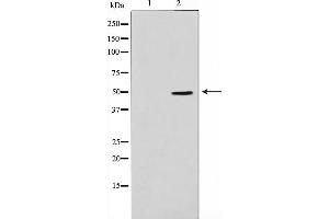 Western blot analysis on Jurkat cell lysate using ADPGK Antibody,The lane on the left is treated with the antigen-specific peptide. (ADPGK antibody  (Internal Region))