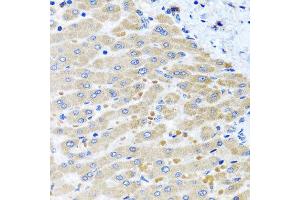 Immunohistochemistry of paraffin-embedded human liver injury using DARS2 antibody at dilution of 1:100 (x40 lens). (DARS2 antibody)