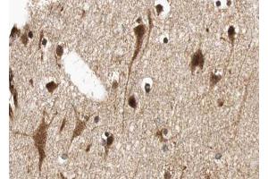 ABIN6268752 at 1/100 staining human brain tissue sections by IHC-P. (MYCN antibody  (Internal Region))
