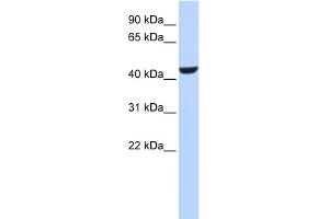 WB Suggested Anti-RDH16 Antibody Titration:  0.
