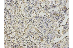 Immunohistochemistry (IHC) image for anti-Nudix (Nucleoside Diphosphate Linked Moiety X)-Type Motif 1 (NUDT1) antibody (ABIN1876662)