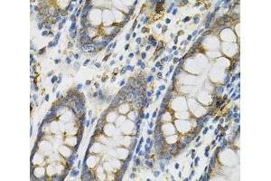 Immunohistochemistry of paraffin-embedded Human colon using DEFB132 Polyclonal Antibody at dilution of 1:100 (40x lens).