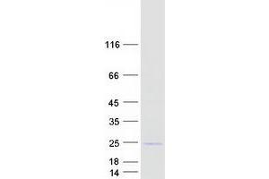 Validation with Western Blot (SPCS3 Protein (Myc-DYKDDDDK Tag))