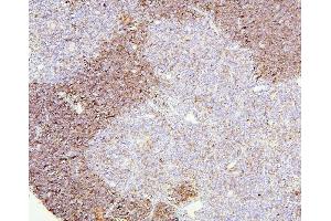 IHC analysis of CD8A using anti-CD8A antibody (ABIN6719524). (CD8 alpha antibody  (AA 27-114))