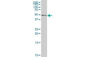 IRX1 polyclonal antibody (A01), Lot # 051025JC01 Western Blot analysis of IRX1 expression in Y-79 . (IRX1 antibody  (AA 424-479))