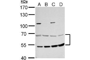 WB Image MCD antibody detects MCD protein by western blot analysis. (MLYCD antibody)