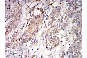 Immunohistochemistry (IHC) image for anti-Complement Component 1, Q Subcomponent, A Chain (C1QA) (AA 23-167) antibody (ABIN5863257)