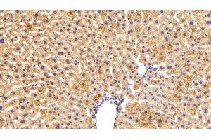 Detection of C3 Convertase in Mouse Liver Tissue using Polyclonal Antibody to Complement C3 Convertase (C3 Convertase) (Complement C3 Convertase antibody)