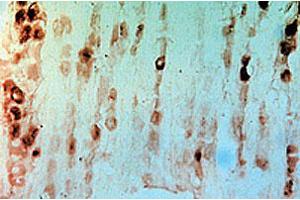 Immunohistochemical staining of rat dorsal root ganglia using rabbit Gfra3 polyclonal antibody  . (GFRA3 antibody  (AA 1-11))