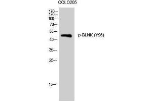 Western Blotting (WB) image for anti-B-Cell Linker (BLNK) (pTyr96) antibody (ABIN3173247) (B-Cell Linker antibody  (pTyr96))