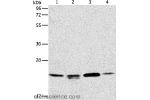 Western blot analysis of 293T, hela and PC3 cell, human liver cancer tissue, using PRDX2 Polyclonal Antibody at dilution of 1:750