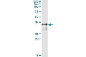 Immunoprecipitation of TOMM34 transfected lysate using anti-TOMM34 monoclonal antibody and Protein A Magnetic Bead , and immunoblotted with TOMM34 MaxPab rabbit polyclonal antibody. (TOMM34 antibody  (AA 1-309))